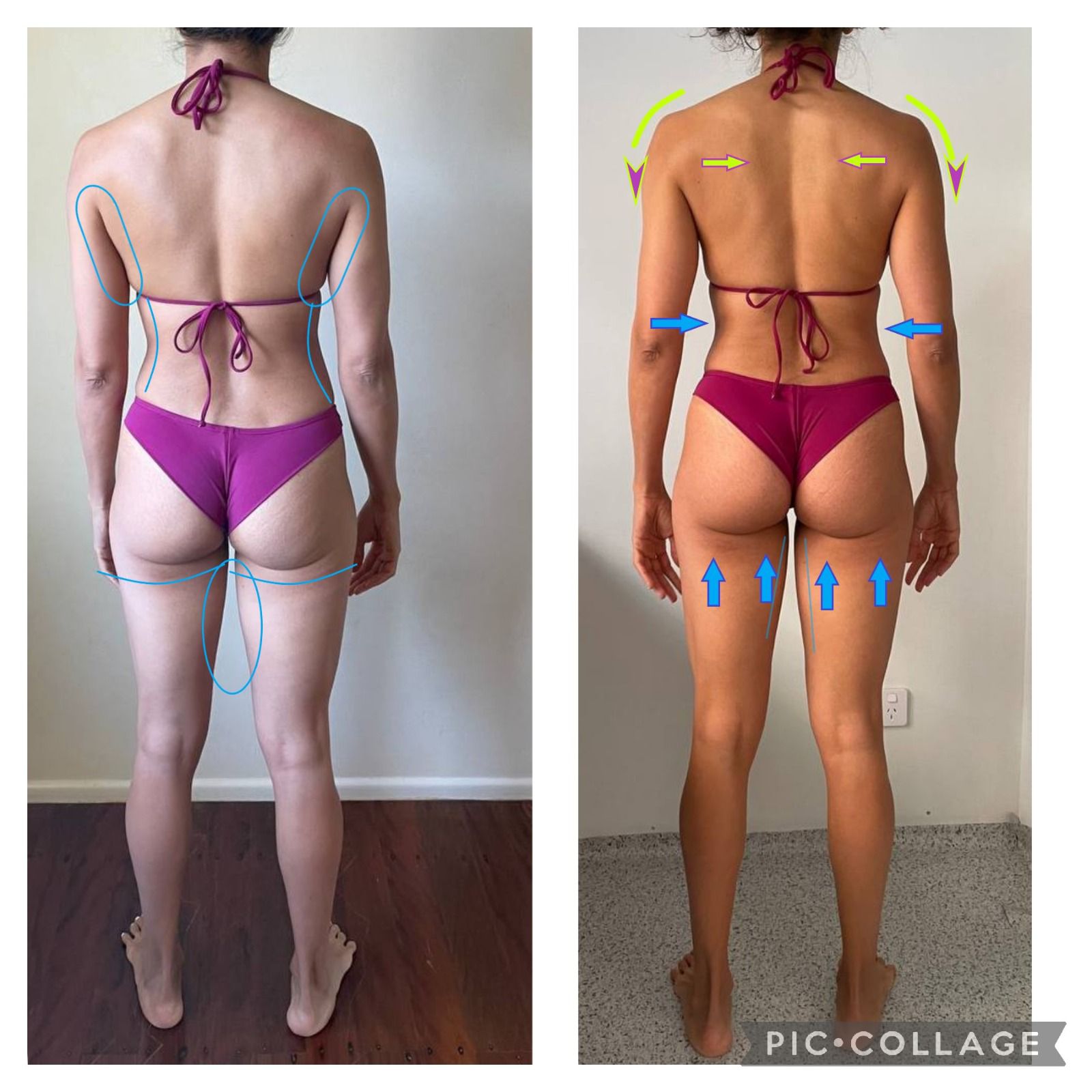 Resultado de aluna 3 — antes e depois do Intensivo Amnésia Glútea