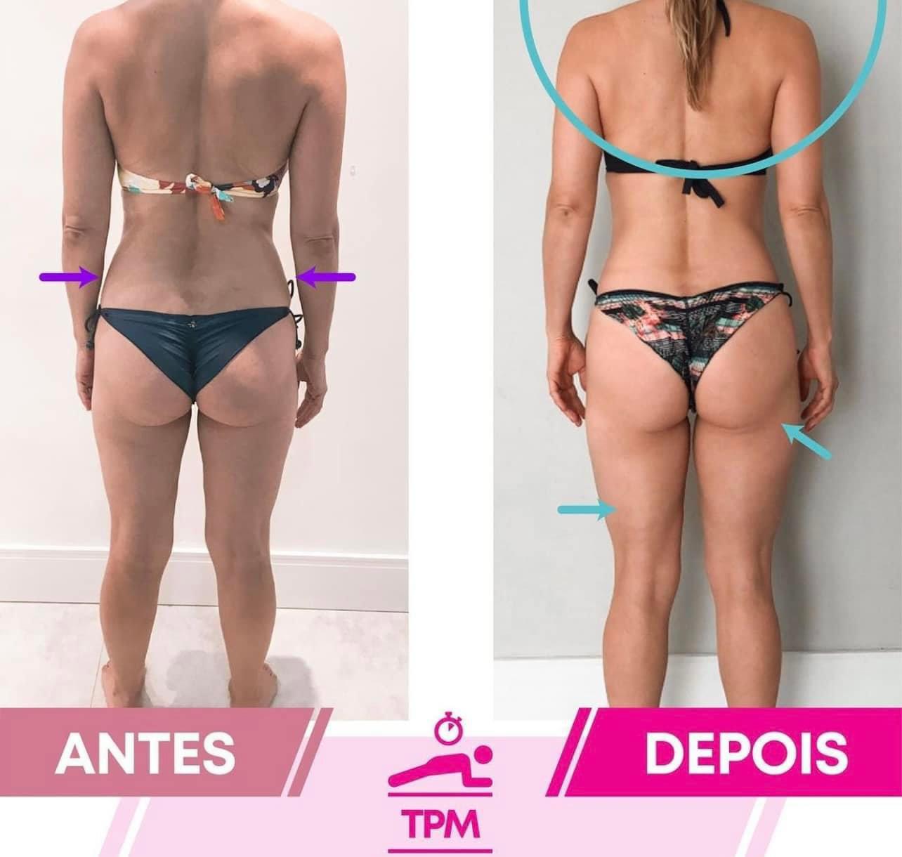 Resultado de aluna 4 — antes e depois do Intensivo Amnésia Glútea