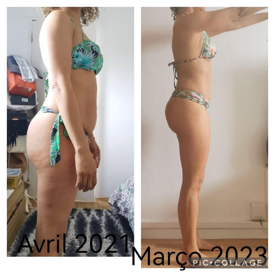 Resultado de aluna 6 — antes e depois do Intensivo Amnésia Glútea