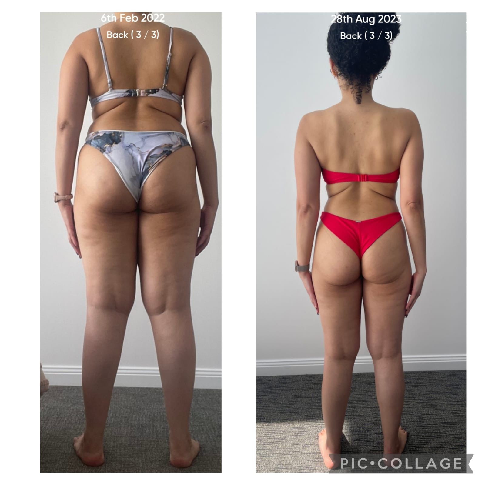 Resultado de aluna 7 — antes e depois do Intensivo Amnésia Glútea
