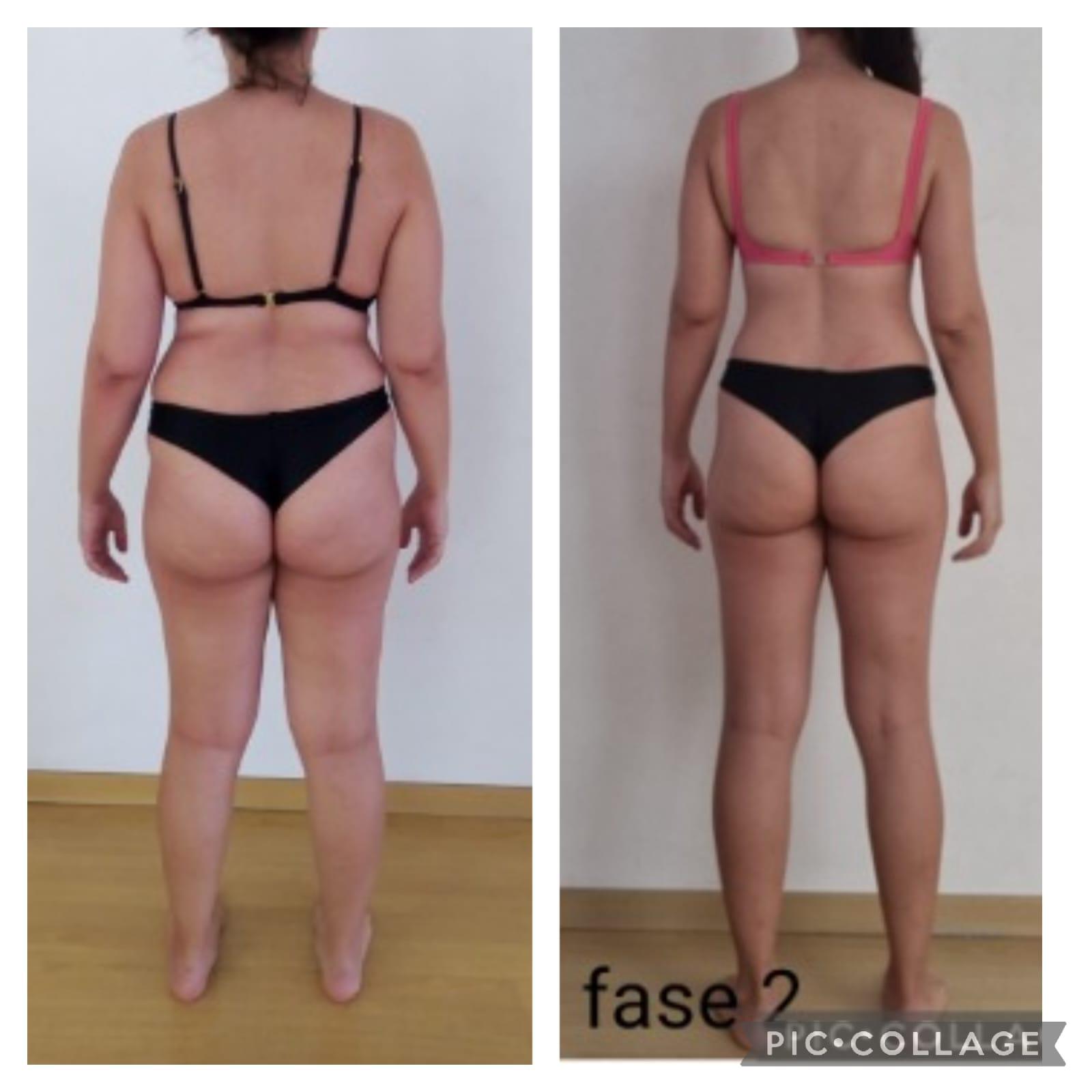 Resultado de aluna 8 — antes e depois do Intensivo Amnésia Glútea