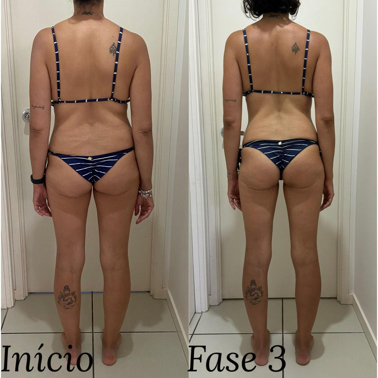 Resultado de aluna 9 — antes e depois do Intensivo Amnésia Glútea